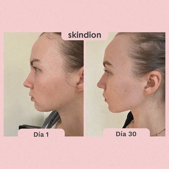 MASAJEADOR FACIAL ADELGAZANTE