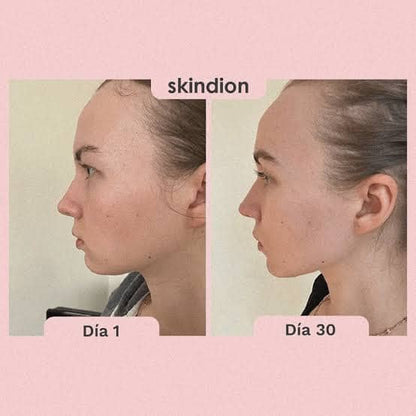 MASAJEADOR FACIAL ADELGAZANTE