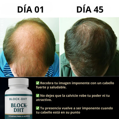 RenovaCapil™ Bloqueador de DHT | Adiós a la caída! Y recupera tu cabello en tan solo 4 Semanas