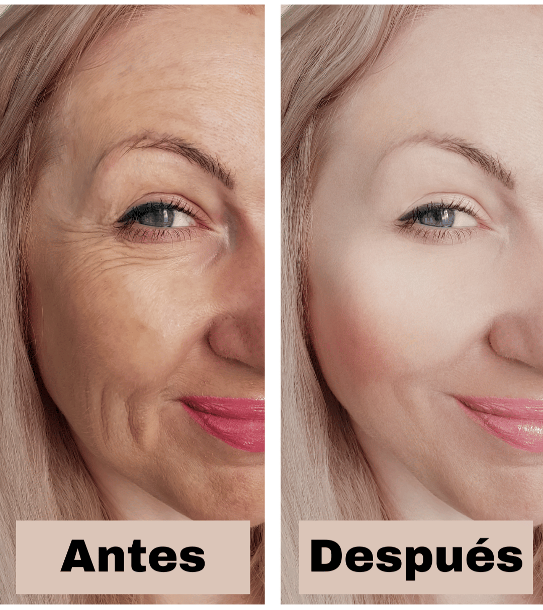 MASAJEADOR FACIAL ADELGAZANTE